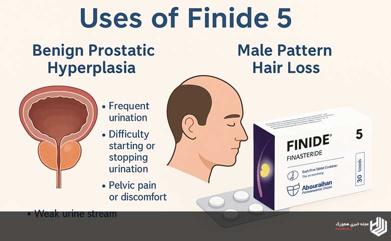 مواردی که قرص finide 5 تجویز می شود
