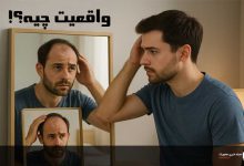 آیا خودارضایی باعث ریزش مو میشود