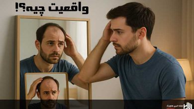 آیا خودارضایی باعث ریزش مو می‌شود
